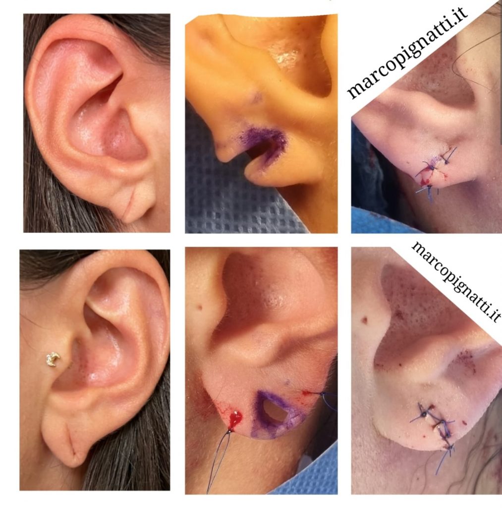 Piercing, dilatatori orecchie
